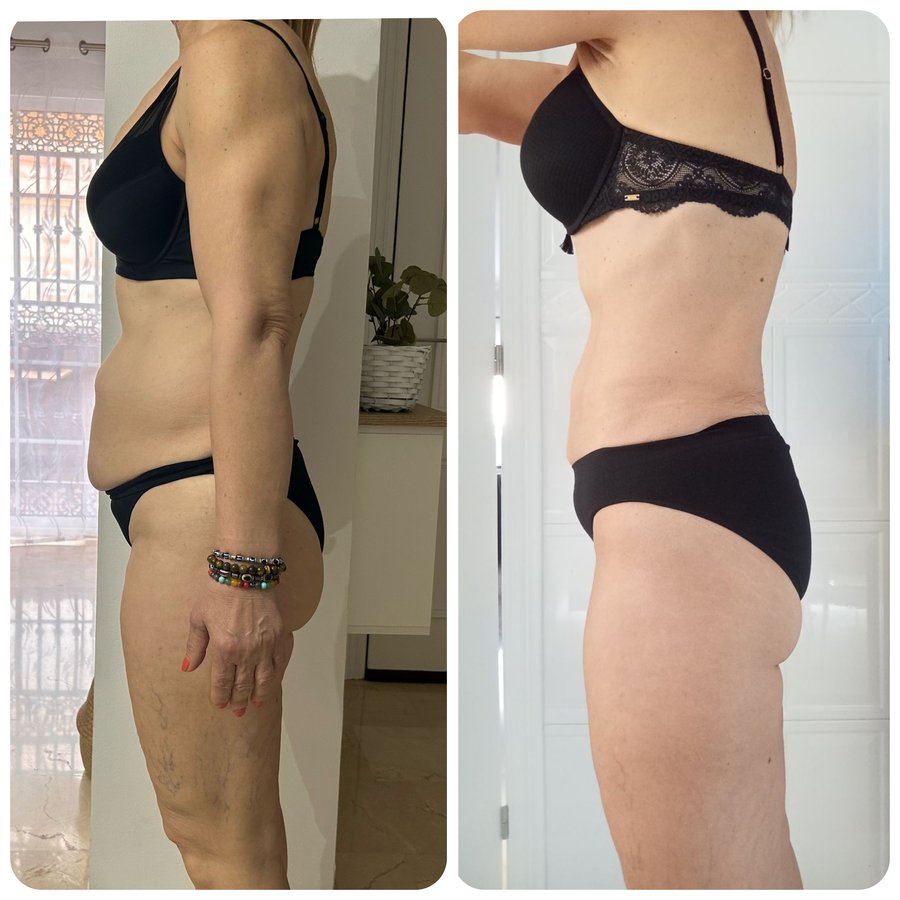Transformación Carmen, 56 años